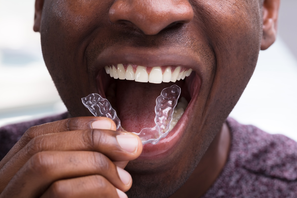 Invisalign provider, Balcones Family Dental, Austin TX dentist, Dr. Ross Maddox, Dr. Sharaf, Dr. Christopher Glecos, Invisalign treatment, advanced dental technology, comprehensive dental care, flexible scheduling