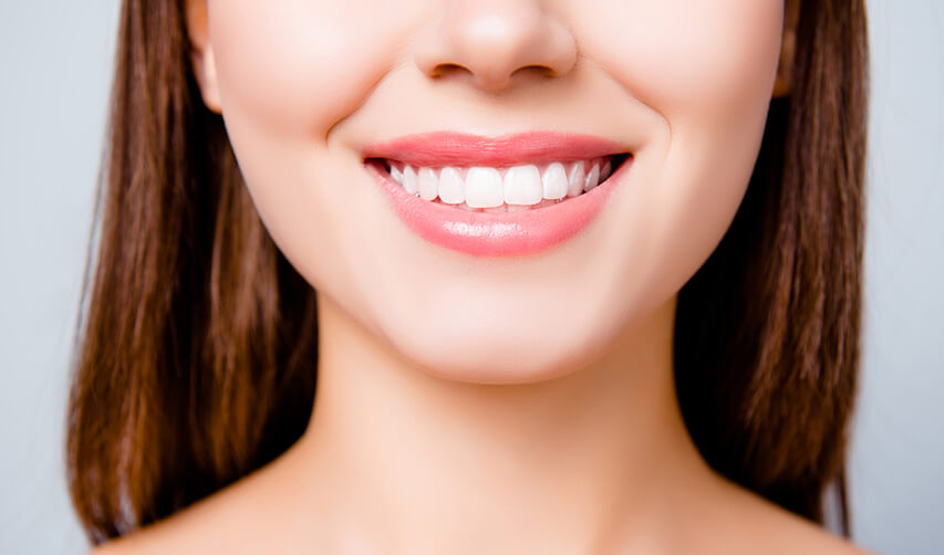 closeup of a woman's bright, white smile