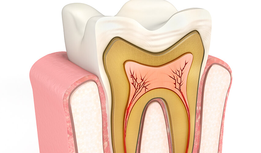 illustration of what the interior of a tooth looks like